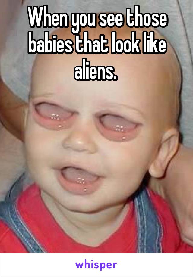 When you see those babies that look like aliens. 






