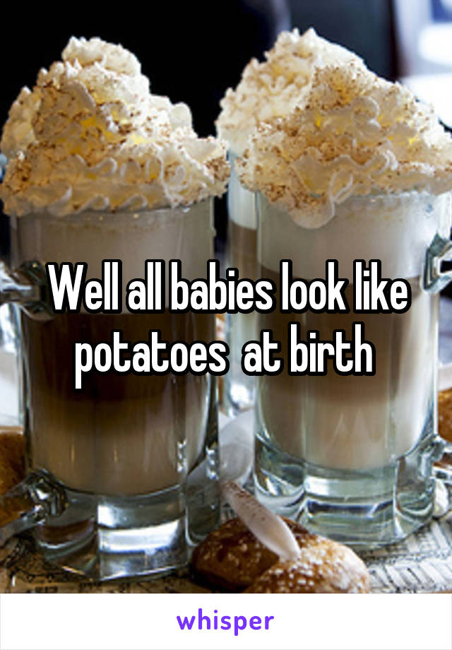 Well all babies look like potatoes  at birth 