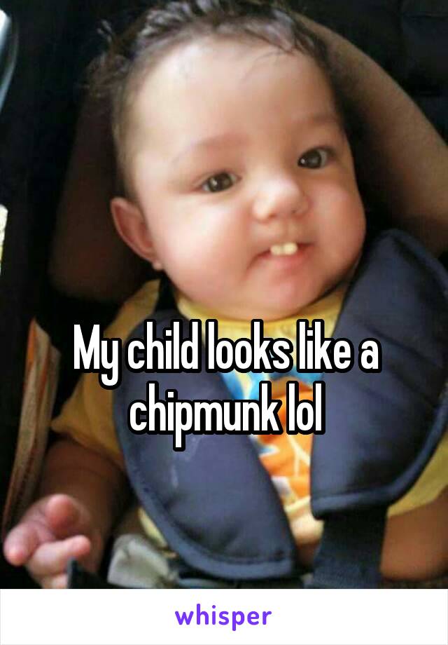 

My child looks like a chipmunk lol