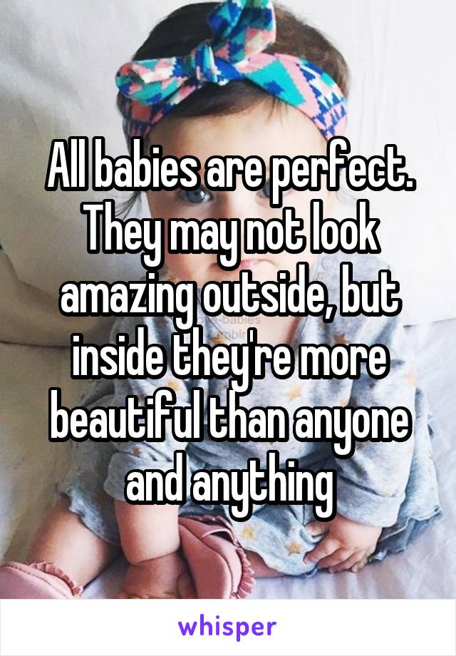 All babies are perfect. They may not look amazing outside, but inside they're more beautiful than anyone and anything