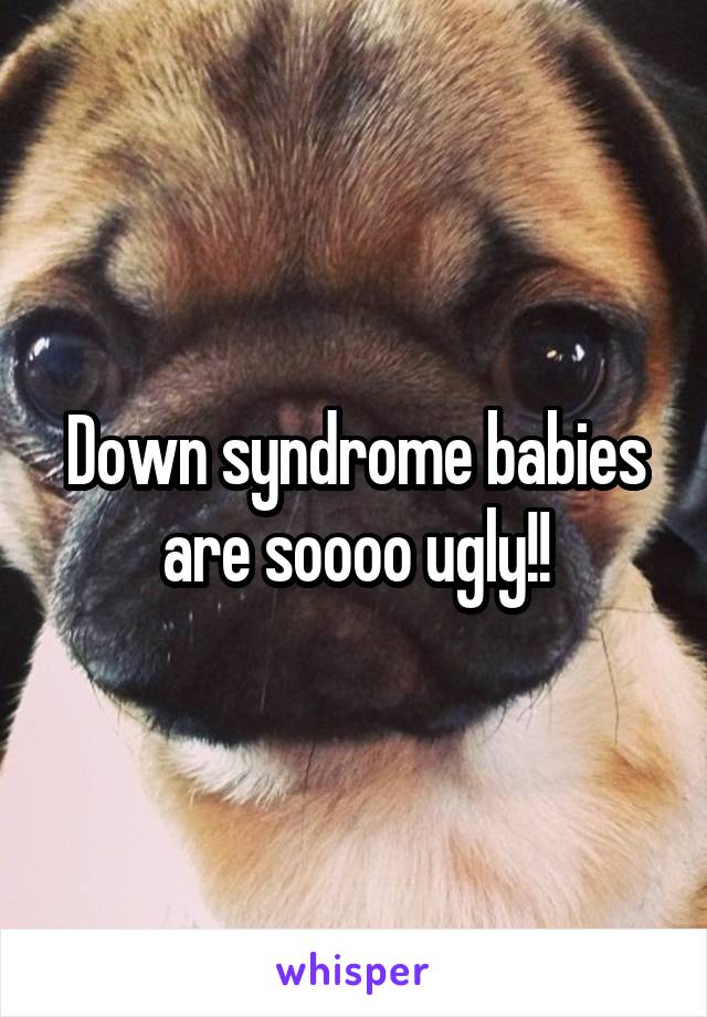 Down syndrome babies are soooo ugly!!