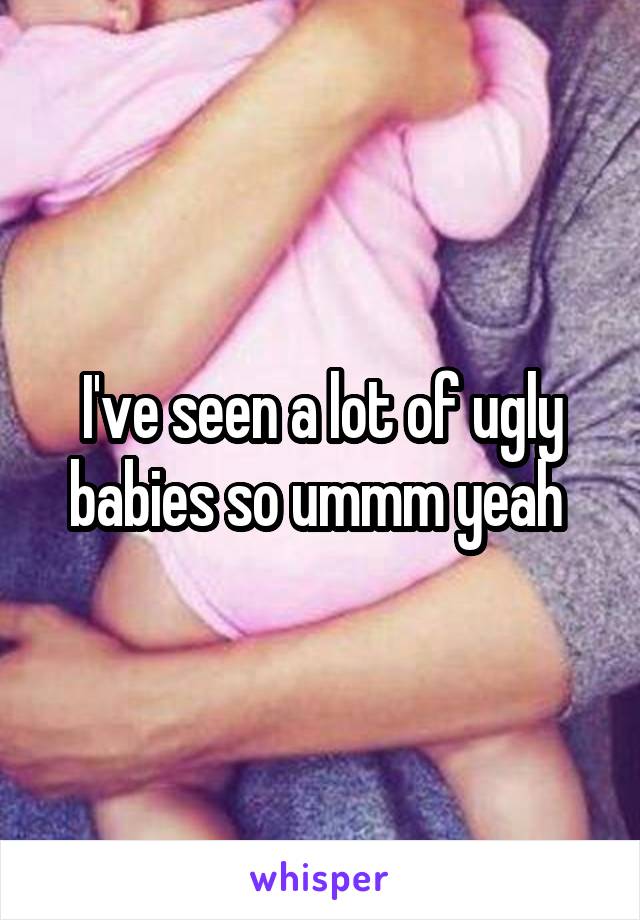 I've seen a lot of ugly babies so ummm yeah 