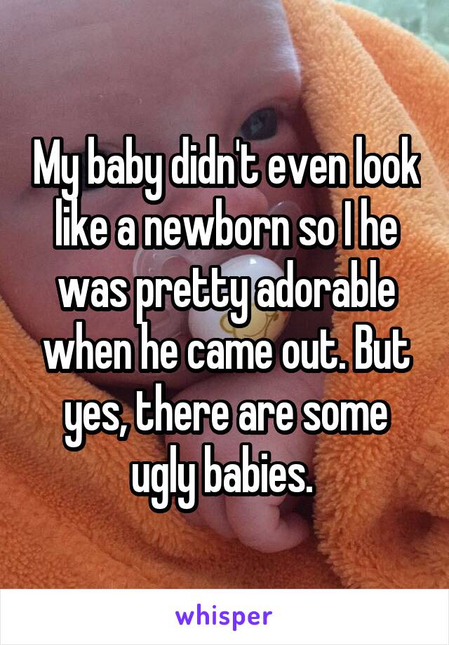 My baby didn't even look like a newborn so I he was pretty adorable when he came out. But yes, there are some ugly babies. 