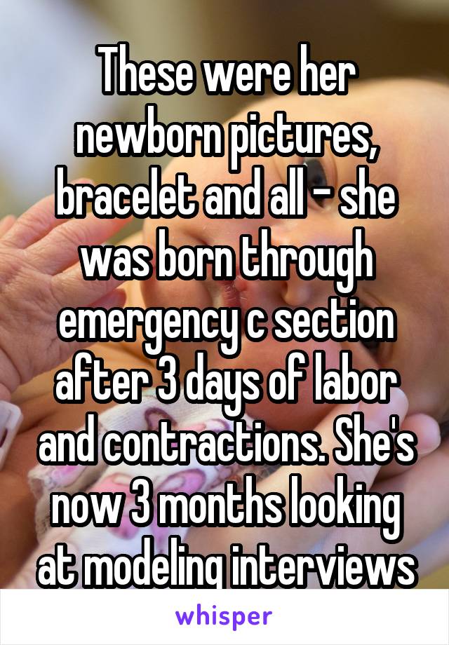 These were her newborn pictures, bracelet and all - she was born through emergency c section after 3 days of labor and contractions. She's now 3 months looking at modeling interviews