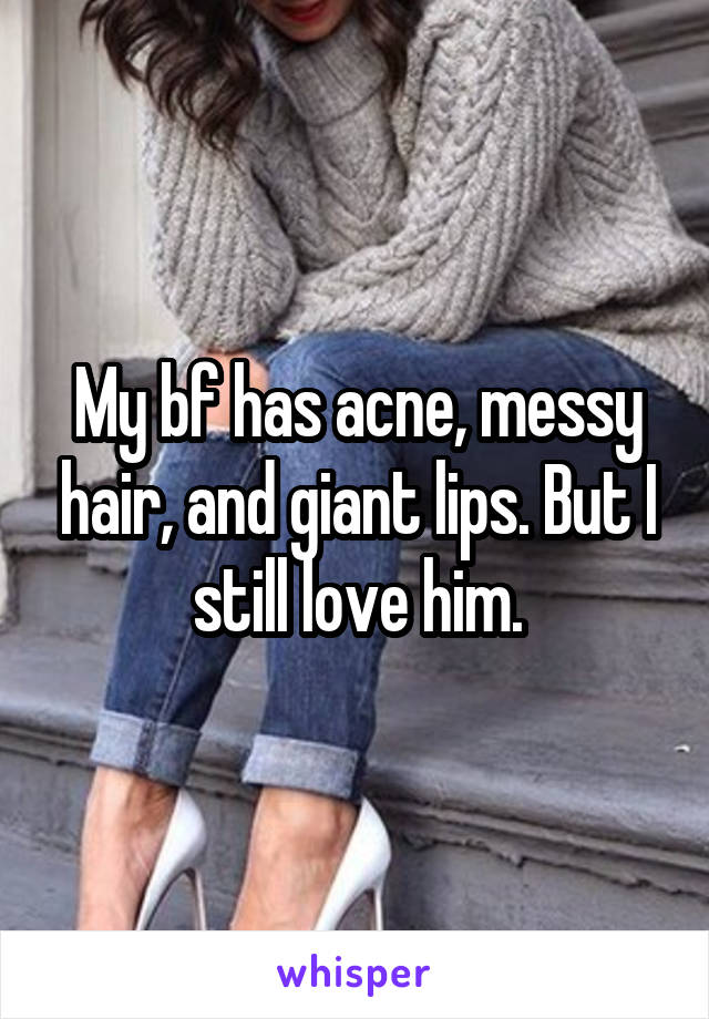 My bf has acne, messy hair, and giant lips. But I still love him.