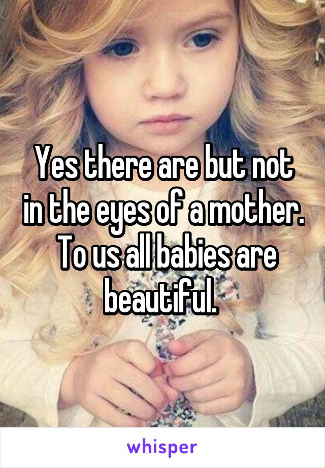 Yes there are but not in the eyes of a mother.  To us all babies are beautiful. 