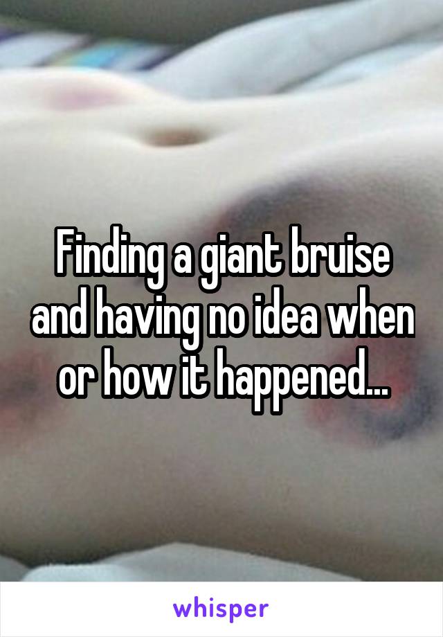 Finding a giant bruise and having no idea when or how it happened...