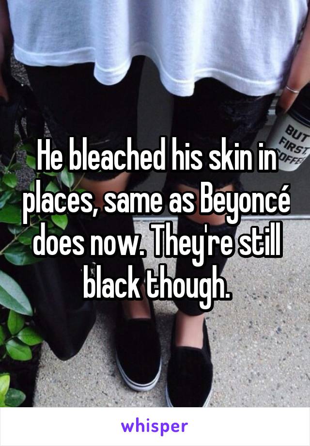 He bleached his skin in places, same as Beyoncé does now. They're still black though.