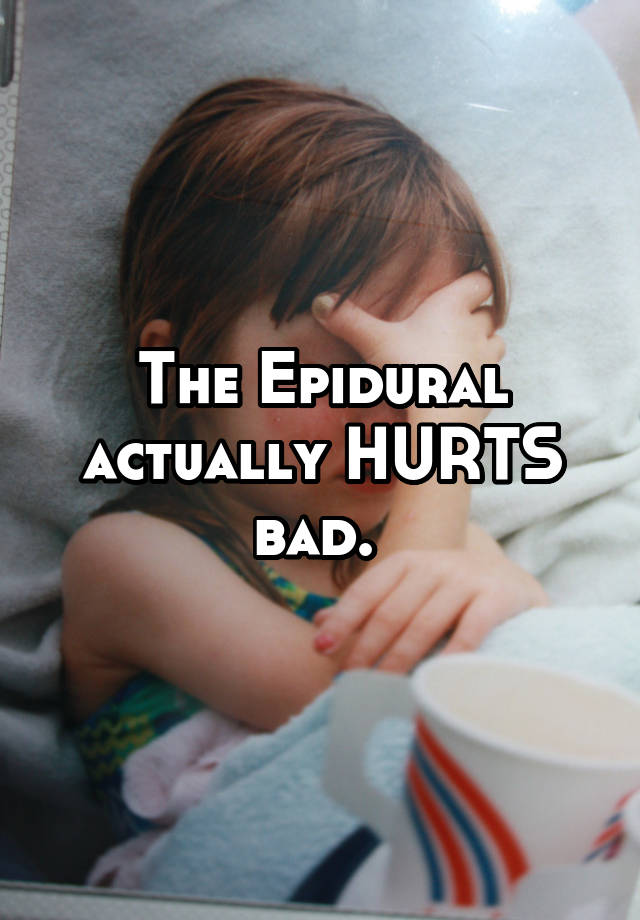 the-epidural-actually-hurts-bad