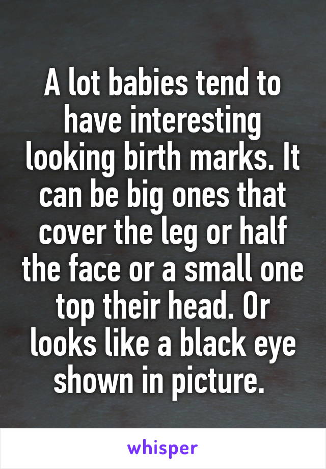 A lot babies tend to have interesting looking birth marks. It can be big ones that cover the leg or half the face or a small one top their head. Or looks like a black eye shown in picture. 