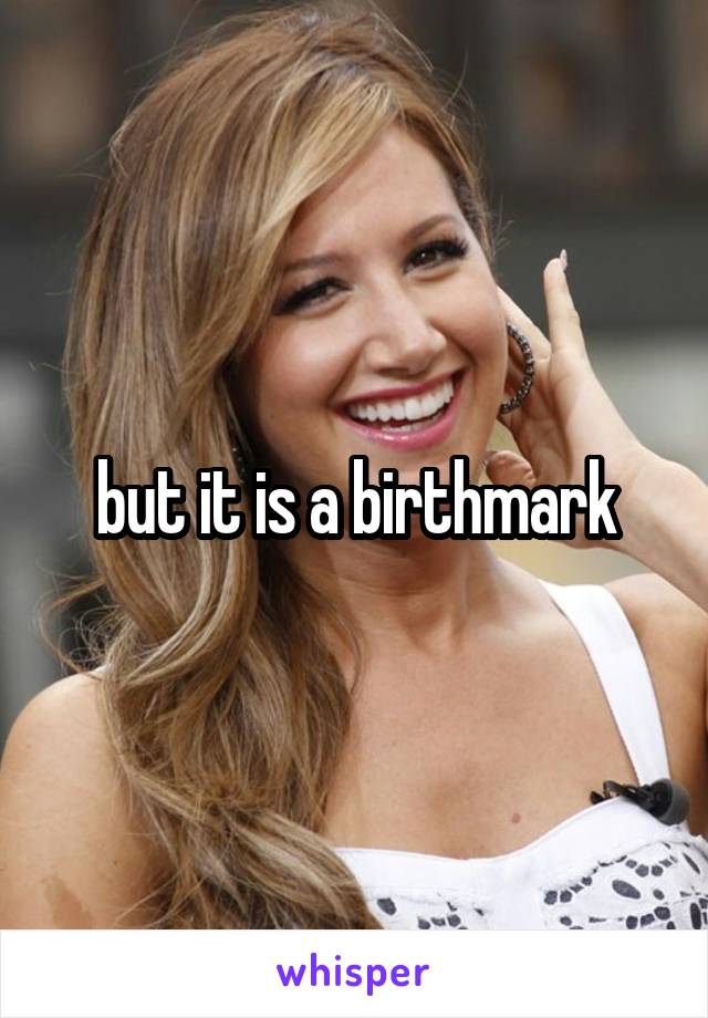 but it is a birthmark