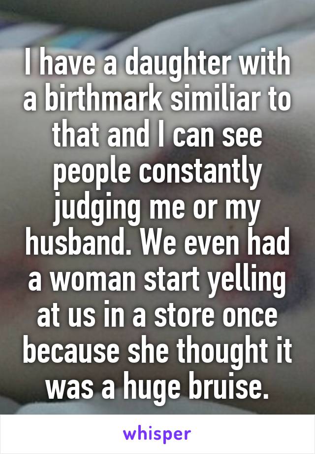 I have a daughter with a birthmark similiar to that and I can see people constantly judging me or my husband. We even had a woman start yelling at us in a store once because she thought it was a huge bruise.