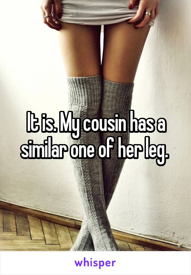 It is. My cousin has a similar one of her leg. 