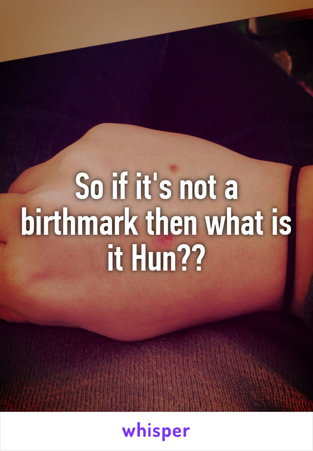 So if it's not a birthmark then what is it Hun??