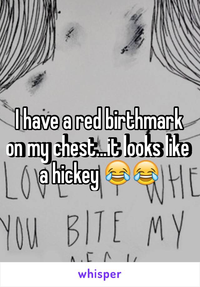 I have a red birthmark on my chest...it looks like a hickey 😂😂