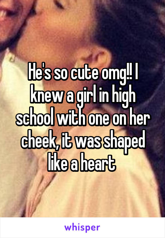 He's so cute omg!! I knew a girl in high school with one on her cheek, it was shaped like a heart 