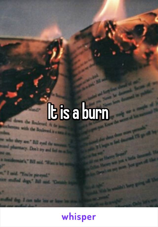 It is a burn 