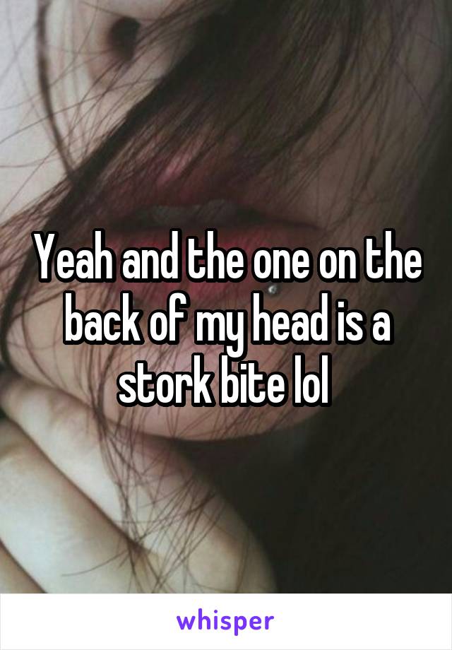 Yeah and the one on the back of my head is a stork bite lol 