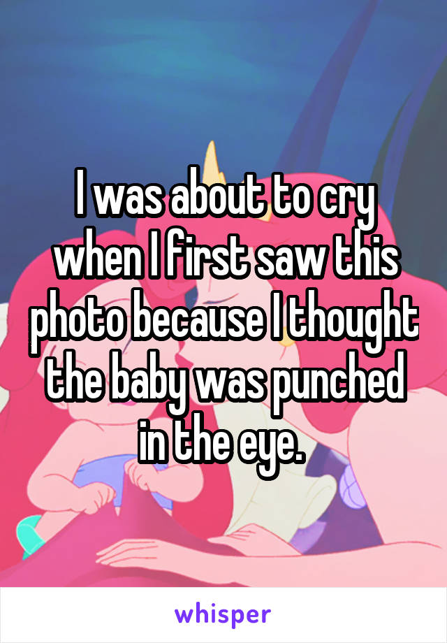 I was about to cry when I first saw this photo because I thought the baby was punched in the eye. 