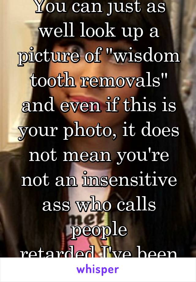 You can just as well look up a picture of "wisdom tooth removals" and even if this is your photo, it does not mean you're not an insensitive ass who calls people retarded.I've been high, I could spell