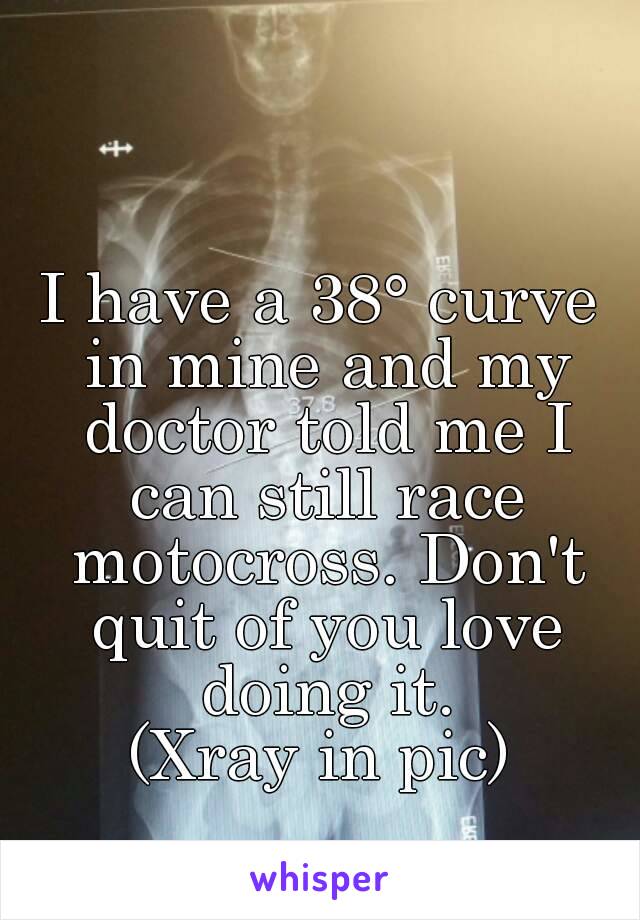 I have a 38° curve in mine and my doctor told me I can still race motocross. Don't quit of you love doing it.
(Xray in pic)