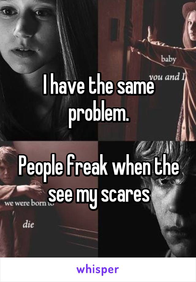 I have the same problem.

People freak when the see my scares