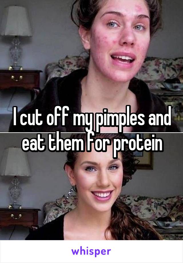 I cut off my pimples and eat them for protein