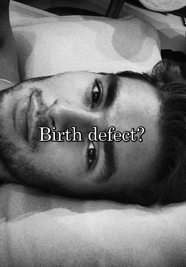 birth-defect