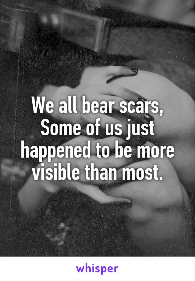 We all bear scars,
Some of us just happened to be more visible than most.