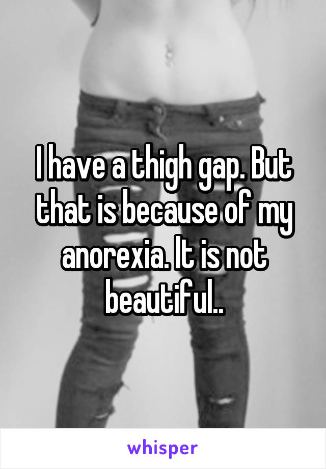 I have a thigh gap. But that is because of my anorexia. It is not beautiful..