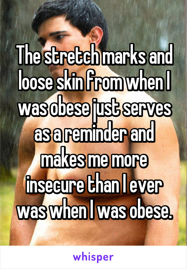 The stretch marks and loose skin from when I was obese just serves as a reminder and makes me more insecure than I ever was when I was obese.