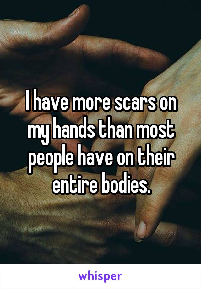 I have more scars on my hands than most people have on their entire bodies.