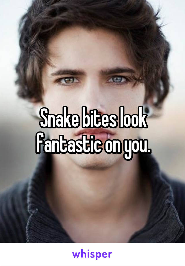 Snake bites look fantastic on you.