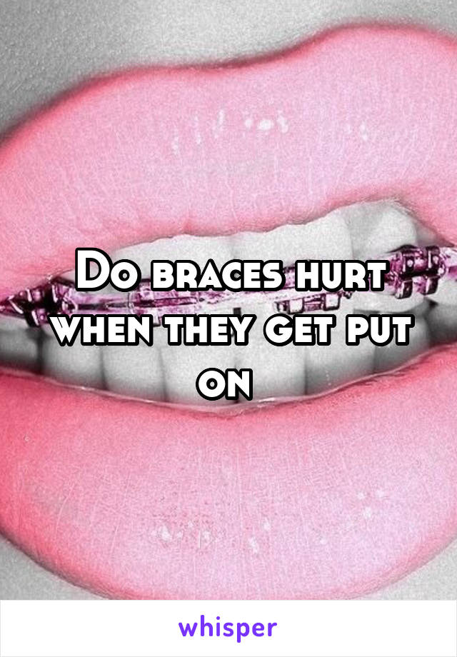Do braces hurt when they get put on 
