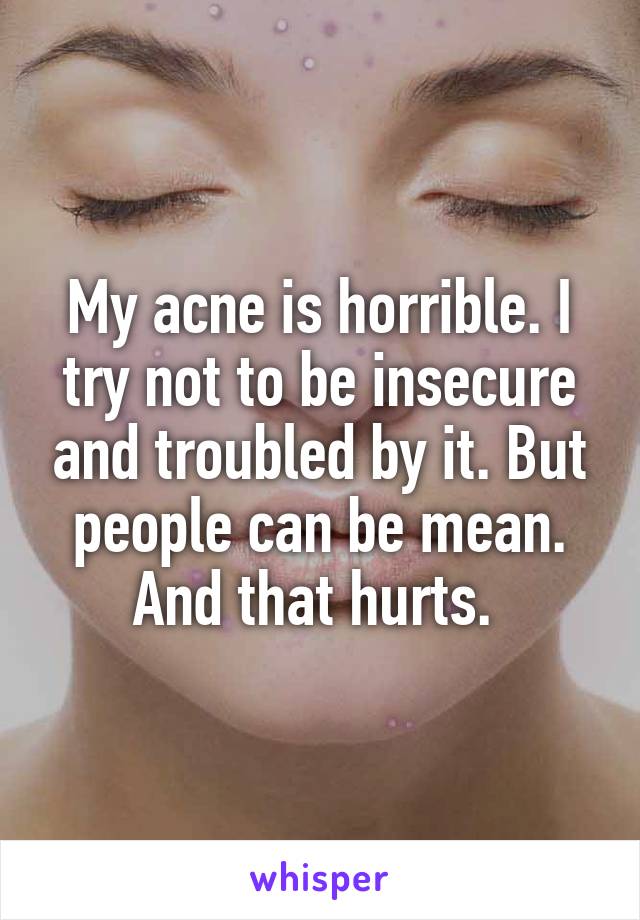 My acne is horrible. I try not to be insecure and troubled by it. But people can be mean. And that hurts. 