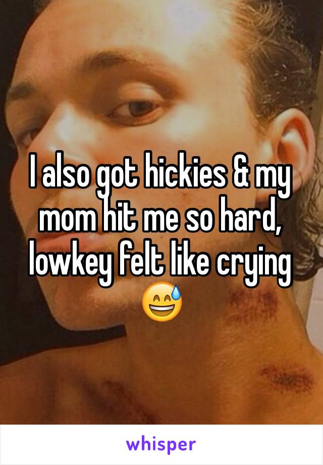 I also got hickies & my mom hit me so hard, lowkey felt like crying 😅