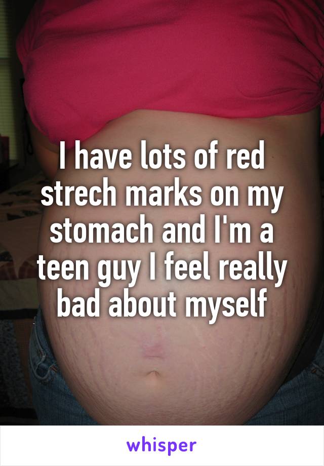 I have lots of red strech marks on my stomach and I'm a teen guy I feel really bad about myself