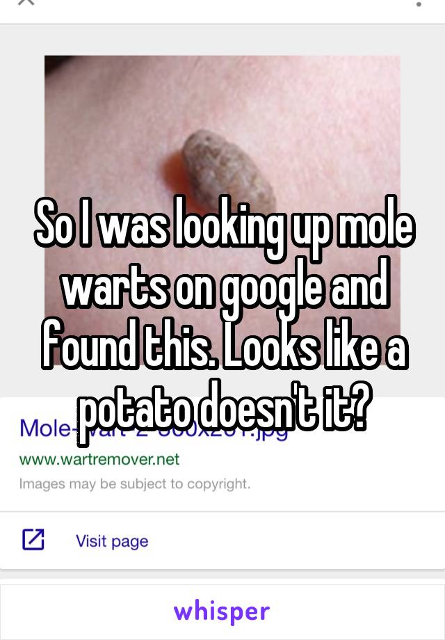 So I was looking up mole warts on google and found this. Looks like a potato doesn't it?