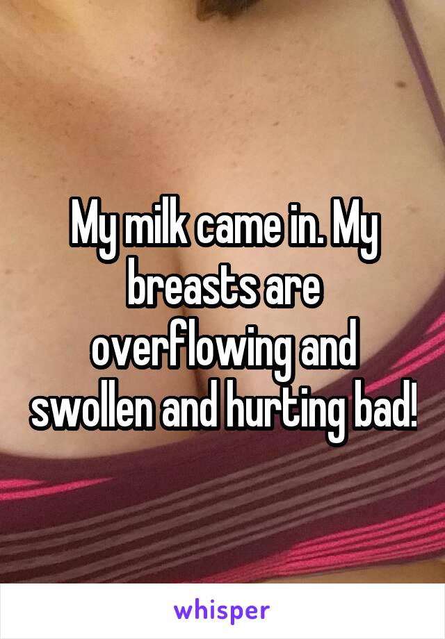 My milk came in. My breasts are overflowing and swollen and hurting bad!