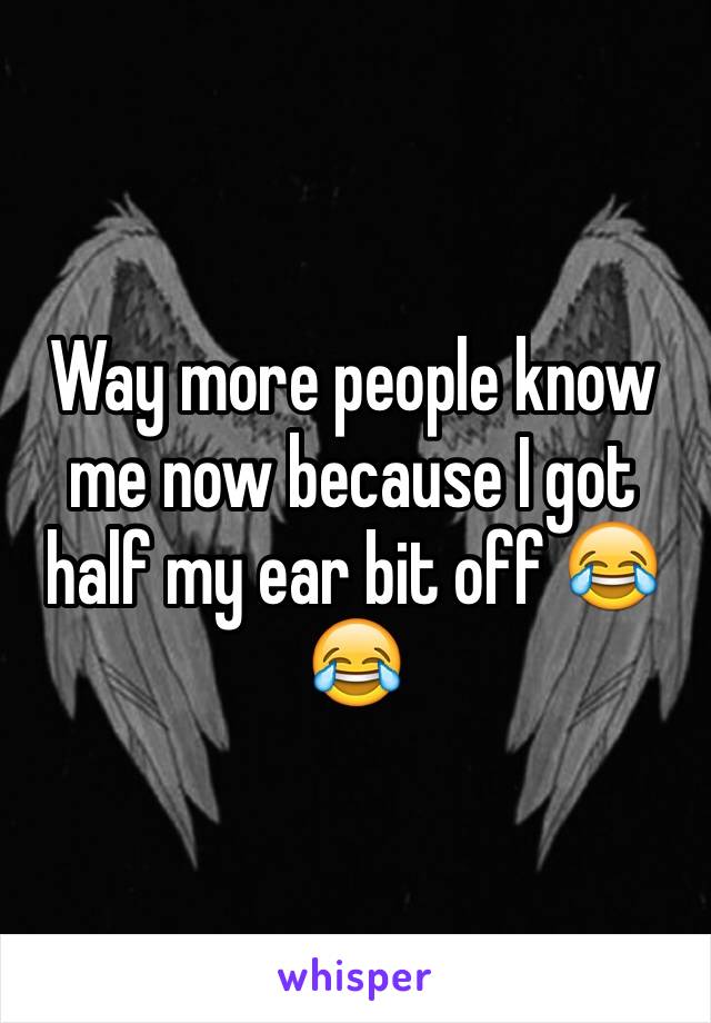 Way more people know me now because I got half my ear bit off ðŸ˜‚ðŸ˜‚