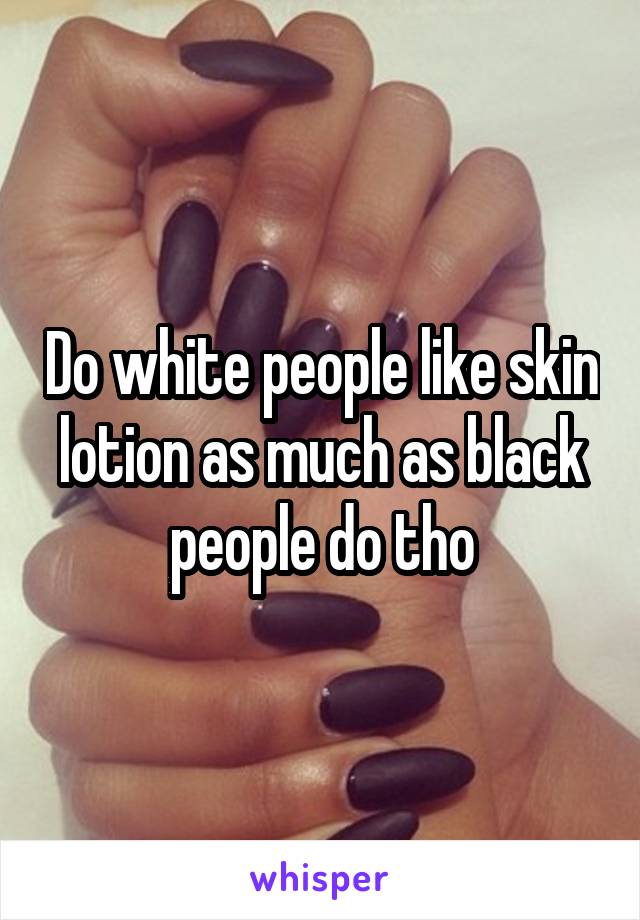 Do white people like skin lotion as much as black people do tho