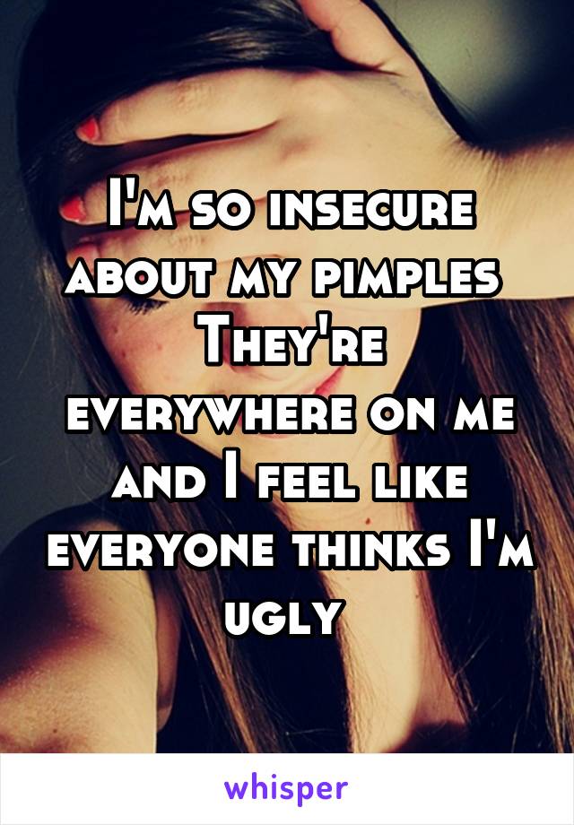 I'm so insecure about my pimples 
They're everywhere on me and I feel like everyone thinks I'm ugly 