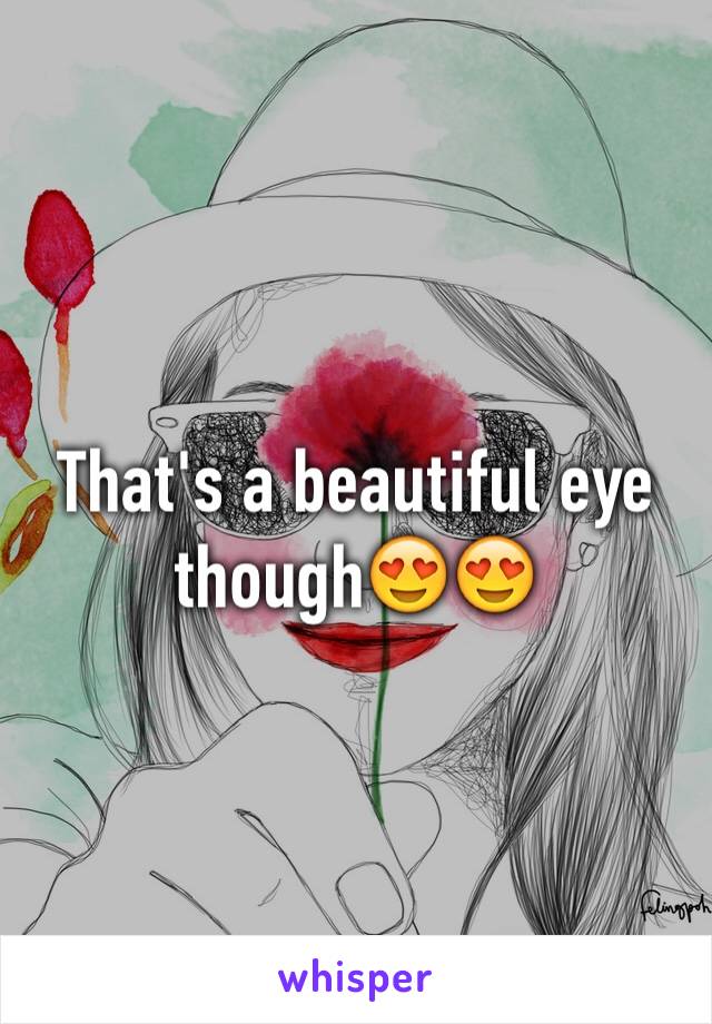 That's a beautiful eye though😍😍