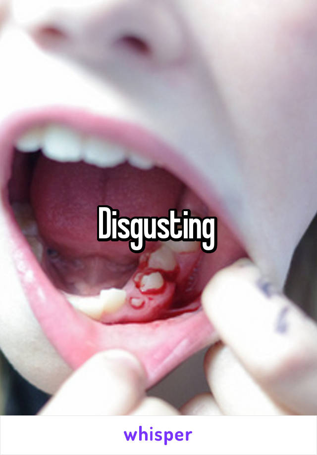 Disgusting 