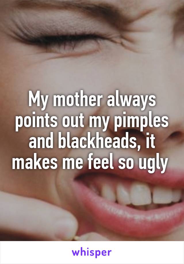 My mother always points out my pimples and blackheads, it makes me feel so ugly 