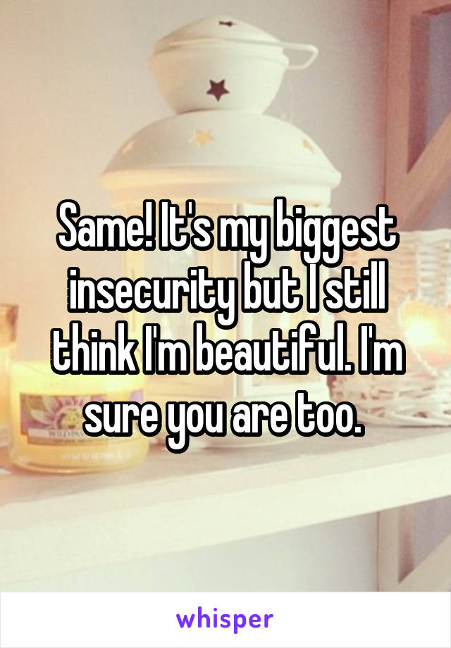 Same! It's my biggest insecurity but I still think I'm beautiful. I'm sure you are too. 