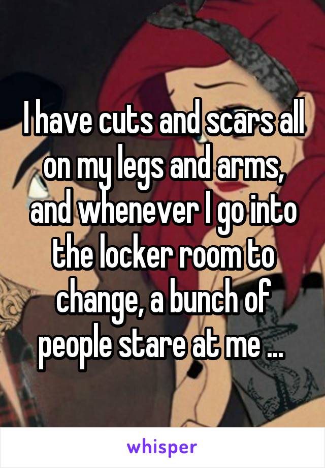 I have cuts and scars all on my legs and arms, and whenever I go into the locker room to change, a bunch of people stare at me ... 