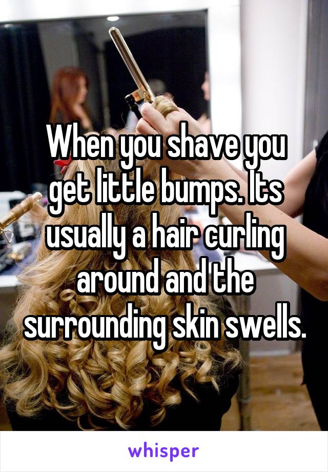 When you shave you get little bumps. Its usually a hair curling around and the surrounding skin swells.