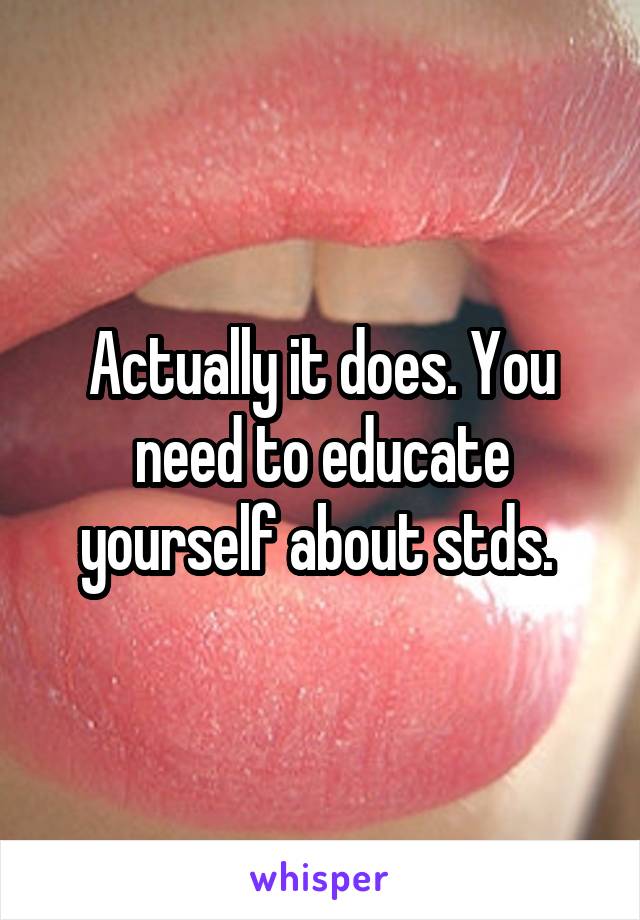 Actually it does. You need to educate yourself about stds. 