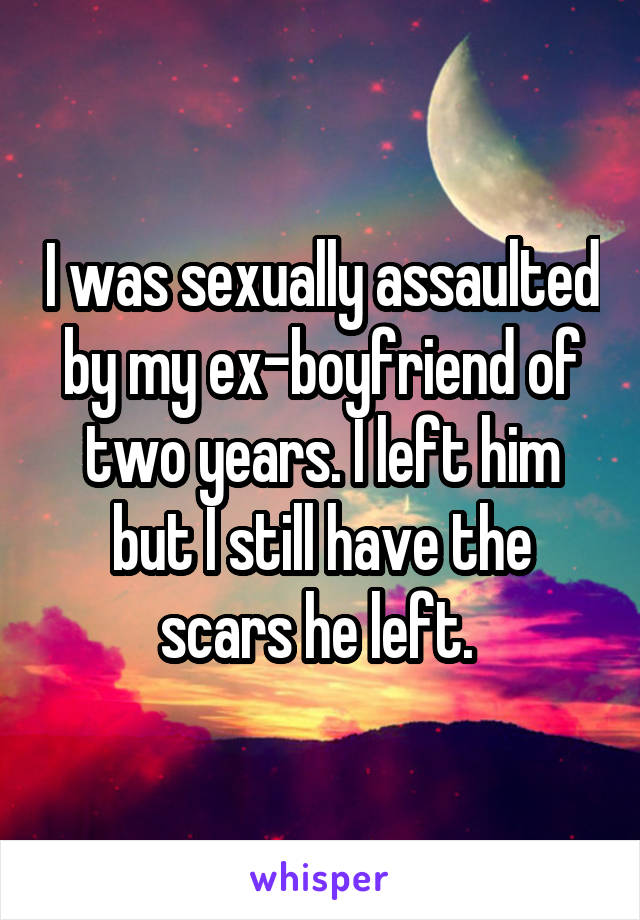 I was sexually assaulted by my ex-boyfriend of two years. I left him but I still have the scars he left. 